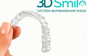 Исправление прикуса капами 3D Smile
